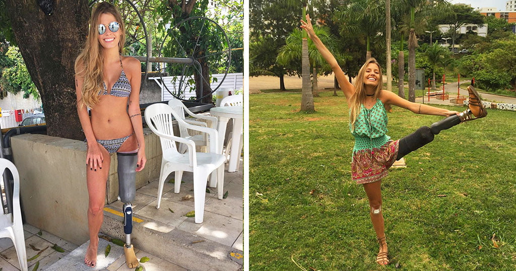 Το ακρωτηριασμένο μοντέλο που έγινε σύμβολο δύναμης και θέλησης.